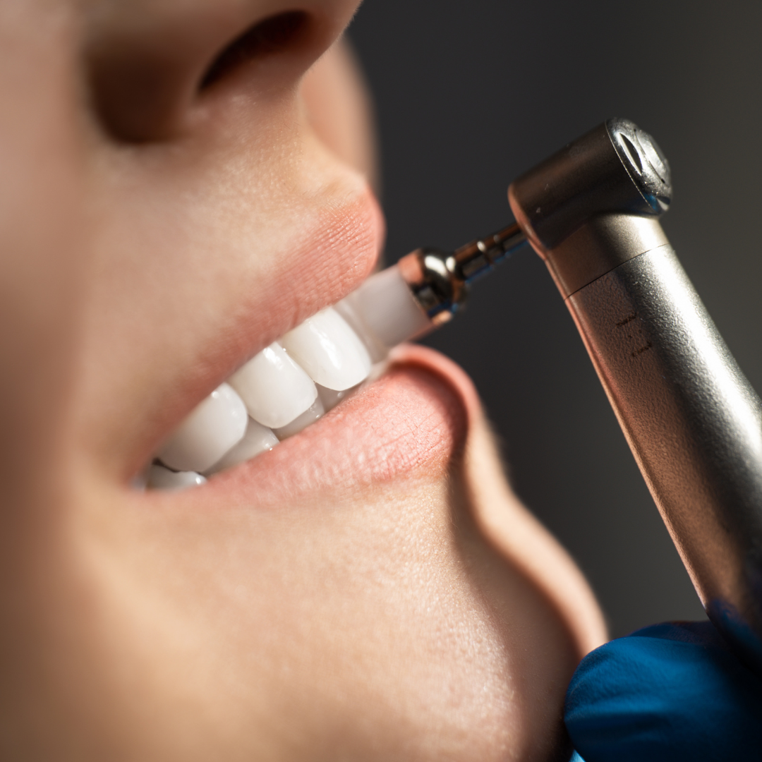 Obturações e estética