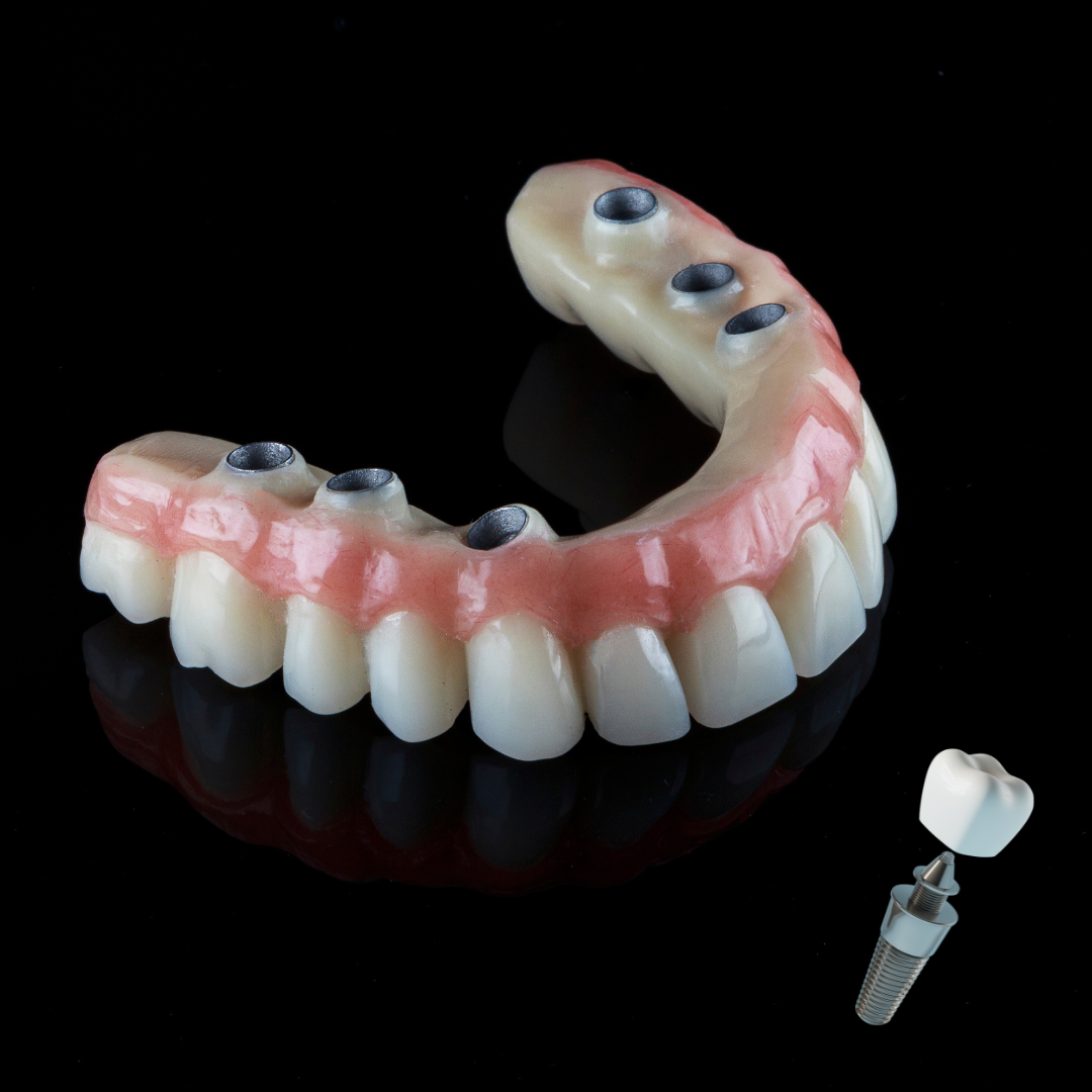 Prótese dentária