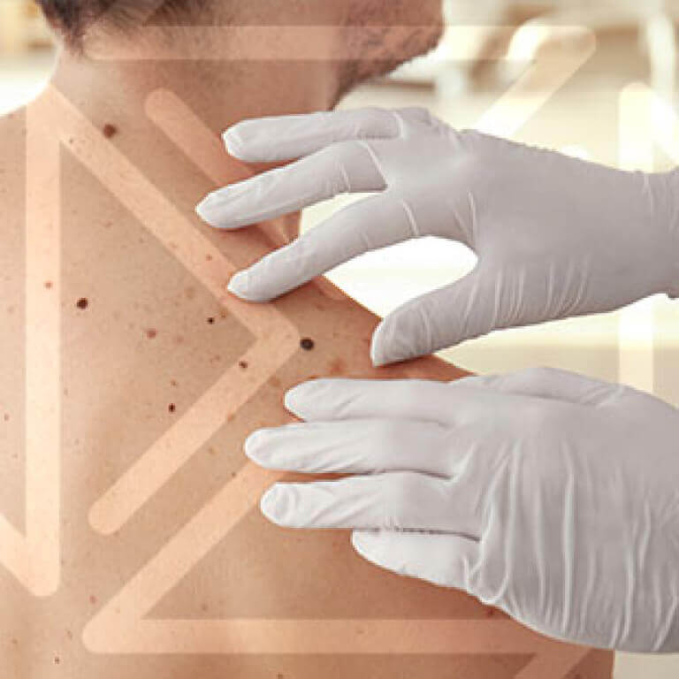 Dermatologia